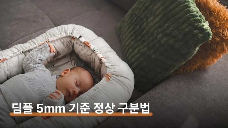 신생아 딤플 5mm 기준 정상이면 검사 없이 지켜봐요